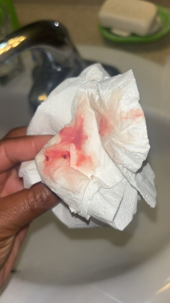 Photo de saignement de nidation