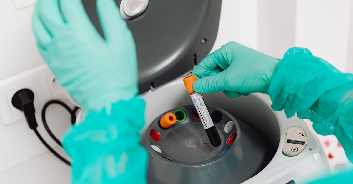 Professionnelle de laboratoire préparant une prise de sang pour un dosage bêta hCG